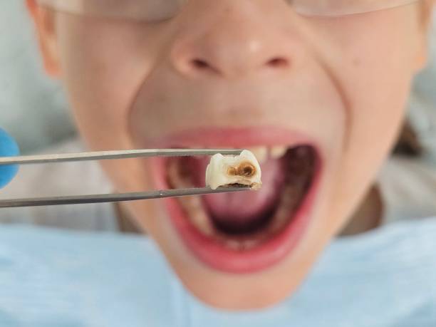 Best Knocked-Out Tooth Emergency  in Tuba City, AZ